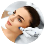 women microneedling