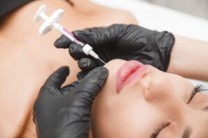 Maintenance of Dermal Filler for Chin