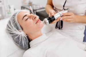 Microneedling for Wrinkles and Fine Lines