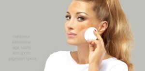 Chemical peel for Melasma