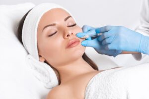 botox for smile lines