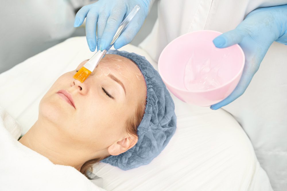 chemical peel for wrinkles