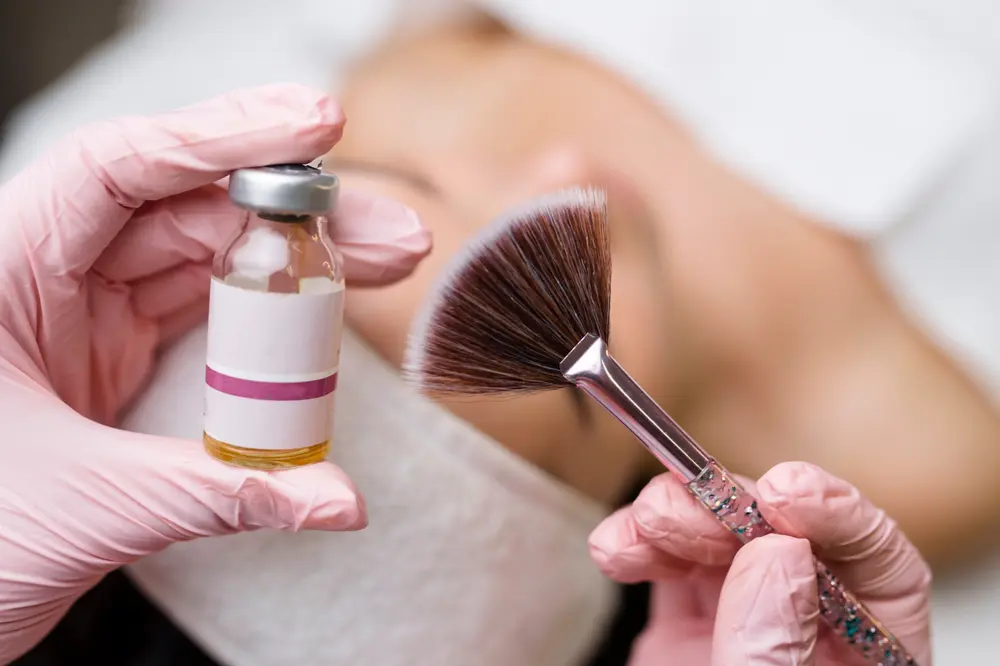 chemical peel treatments in Florida