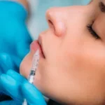 dermal-filler-for-lips-2022-02-08-02-04-42-utc